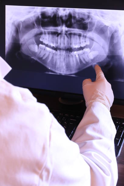Best Emergency Dentist for Knocked-Out Tooth in Springfield, IL