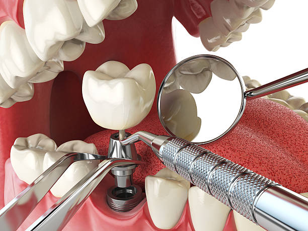 Best Pediatric Emergency Dentist in Springfield, IL
